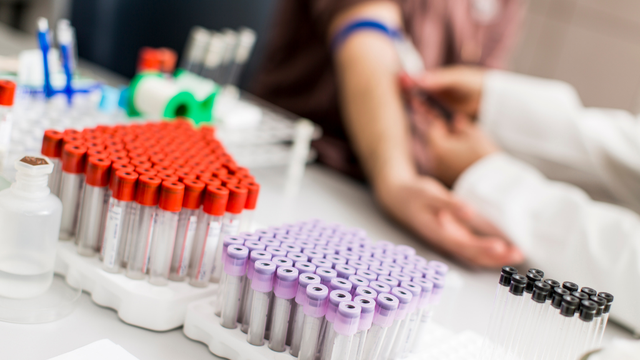 Làm Triple Test có phải nhịn ăn không? Quy trình làm Triple Test và những lưu ý quan trọng