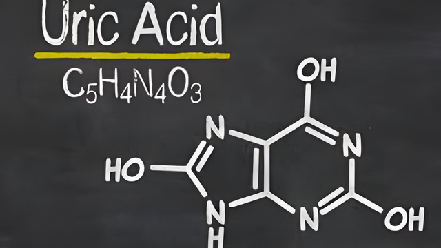 Axit uric cao bao nhiêu thì bị gout? 