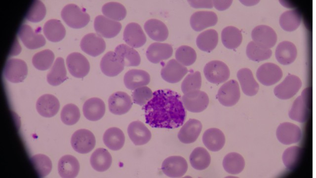 Bạch cầu ái kiềm: Vai trò, chỉ số bình thường và những vấn đề sức khỏe liên quan