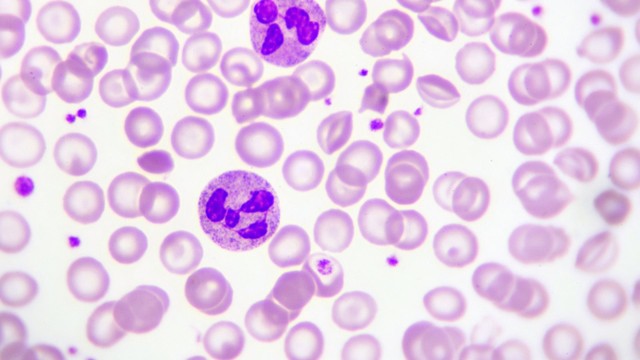 Bạch cầu trung tính: Vai trò, chỉ số bình thường và ý nghĩa xét nghiệm