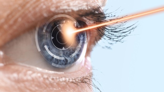 Bắn tia laser trị cận thị bao nhiêu tiền? Điều kiện bắn laser cận thị