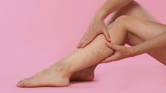 Giãn tĩnh mạch chi dưới: Nguyên nhân, triệu chứng và điều trị