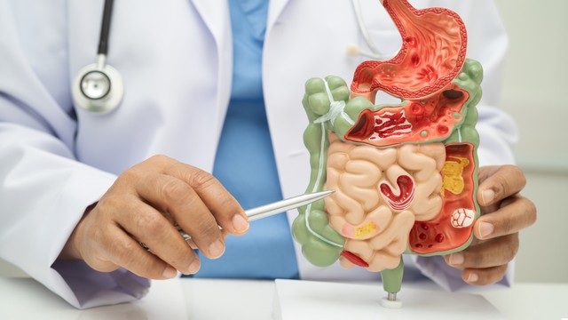 Liệt ruột là gì? Những điều cần biết về liệt ruột