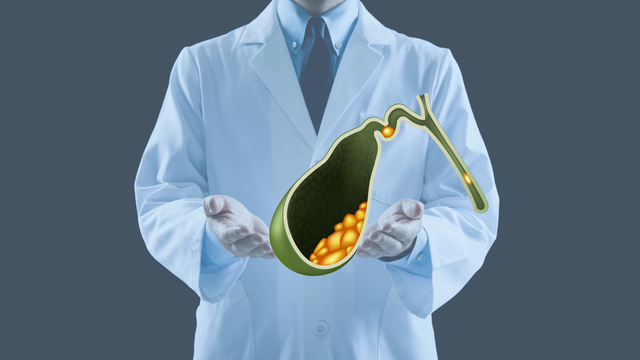 Sỏi bùn túi mật là gì? Triệu chứng, nguyên nhân và cách điều trị