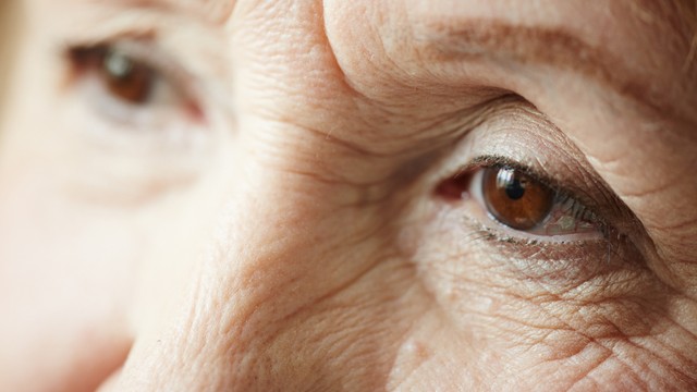 Thoái hóa võng mạc là gì? Nguyên nhân và cách phòng ngừa hiệu quả