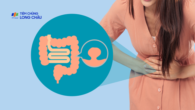 U đại tràng lành tính: Triệu chứng, nguyên nhân, cách điều trị và phòng ngừa