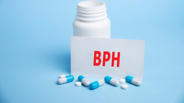 U xơ tiền liệt tuyến là gì? Nguyên nhân và cách phòng ngừa hiệu quả