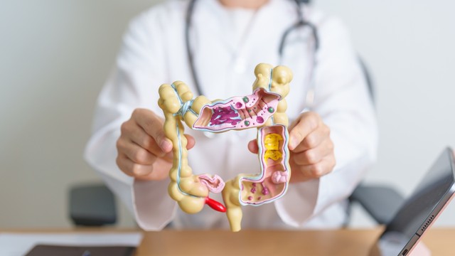 Ung thư đại trực tràng là gì? Nguyên nhân và cách phòng ngừa hiệu quả