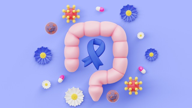 Ung thư trực tràng giai đoạn 3​ là gì? Nguyên nhân, triệu chứng và cách điều trị