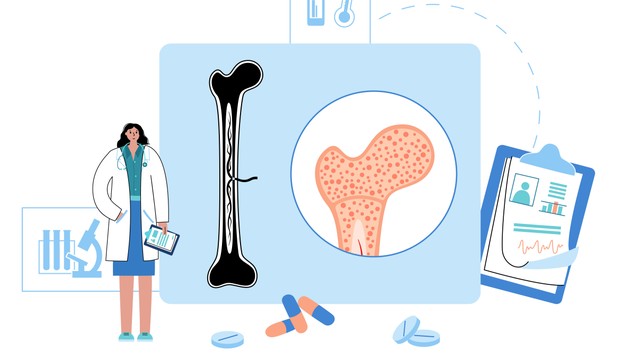 Ung thư tủy xương là gì? Nguyên nhân, triệu chứng và cách điều trị