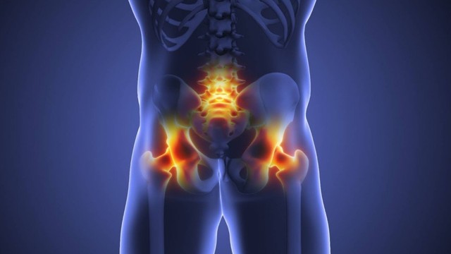 Viêm cột sống dính khớp là gì? Nguyên nhân và cách phòng ngừa hiệu quả