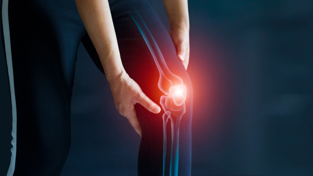 Viêm khớp là gì? Nguyên nhân, triệu chứng, cách điều trị và phòng ngừa