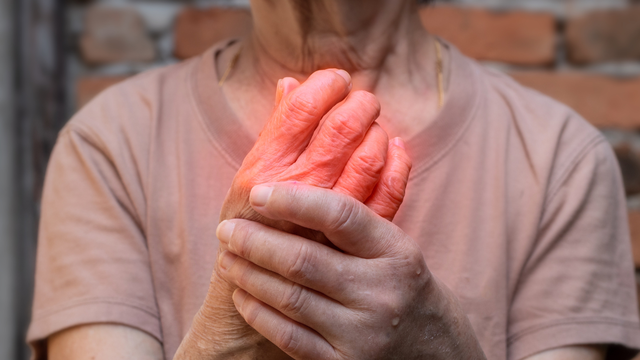 Viêm khớp dạng thấp: Triệu chứng, nguyên nhân, cách điều trị và phòng ngừa