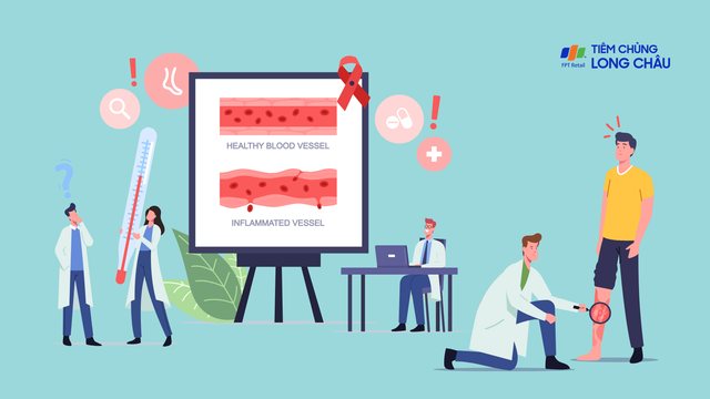 Viêm mạch là bệnh gì? Nguyên nhân, triệu chứng và cách điều trị