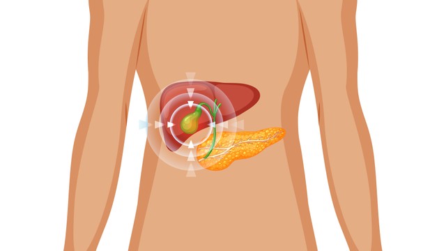 Viêm túi mật cấp là gì? Triệu chứng, nguyên nhân và cách điều trị