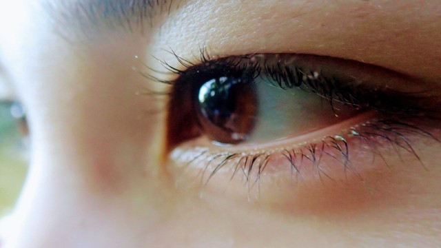 Xước giác mạc là gì? Những điều cần biết về xước giác mạc