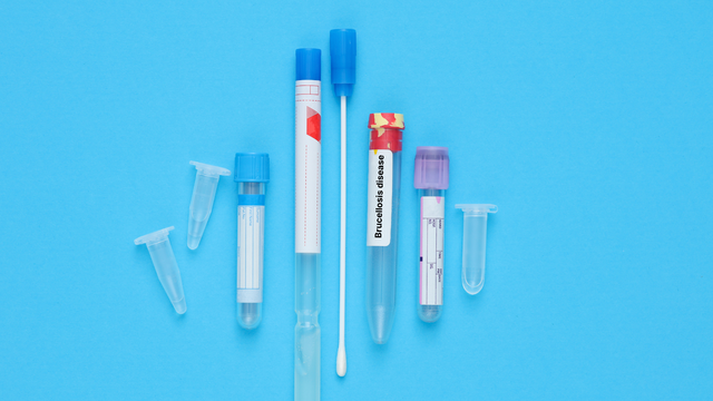 Bệnh Brucella: Nguyên nhân gây bệnh và phương pháp điều trị, phòng ngừa hiệu quả
