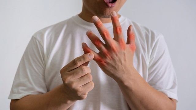 Bệnh gút sống được bao lâu? Cách kéo dài tuổi thọ