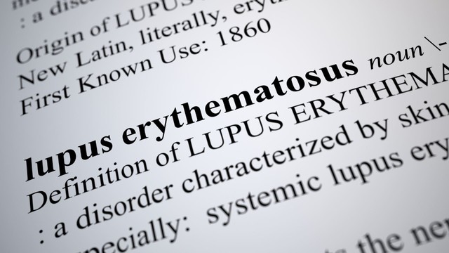 Bệnh lupus ban đỏ giai đoạn đầu: Dấu hiệu, chẩn đoán và điều trị