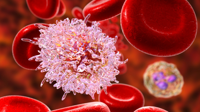 Bệnh máu trắng có chữa được không? Các phương pháp điều trị bệnh máu trắng