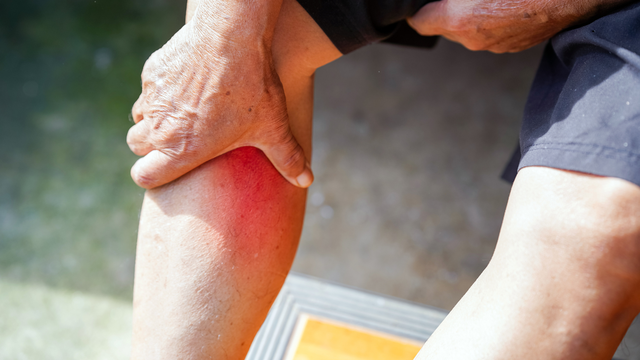 Bệnh phong thấp là gì? Nguyên nhân, triệu chứng và phương pháp điều trị