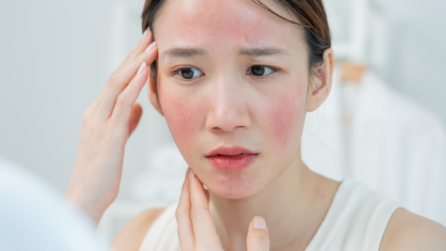 Bị dị ứng thức ăn có được tắm không? Hướng dẫn an toàn