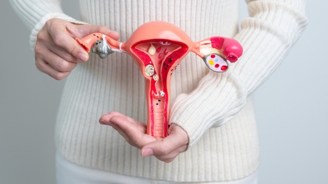 Bị u nang buồng trứng siêu âm những gì? Các loại u nang buồng trứng thường gặp