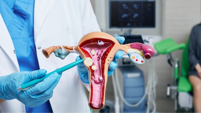 Bị u xơ tử cung có nên mổ không? Những trường hợp bắt buộc phải can thiệp