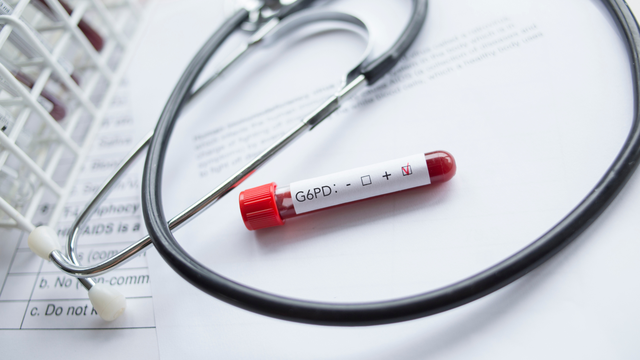 Biểu hiện thiếu men G6PD ở người lớn và cách kiểm soát