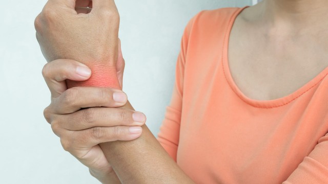 Bong gân cổ tay bao lâu thì khỏi? Thời gian hồi phục cần biết