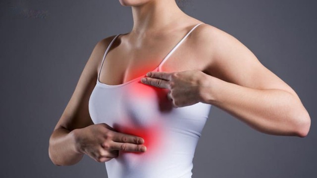 Bướu sợi tuyến BI-RADS 3 là gì? Mức độ nguy hiểm và cách theo dõi an toàn