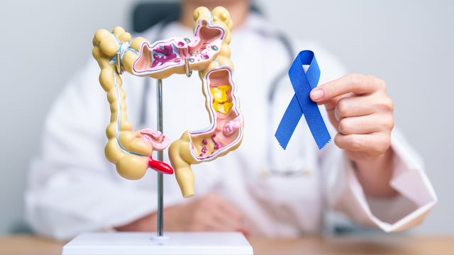 Các triệu chứng ung thư đại tràng giai đoạn đầu cần sớm nhận biết