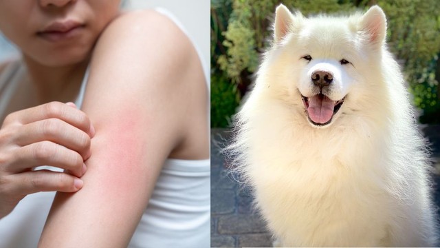 Cách giảm ngứa khi bị sán chó mà bạn nên biết!