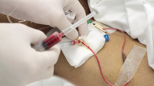 Cách lấy khí máu động mạch: Quy trình an toàn và chuẩn xác cần biết