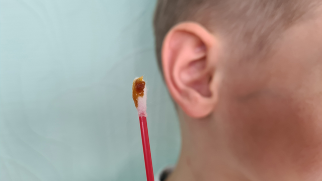 Cách lấy ráy tai sâu bên trong cho trẻ: An toàn và đúng cách