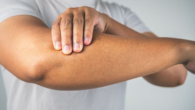 Căng cơ tay: Nguyên nhân, dấu hiệu và cách khắc phục an toàn