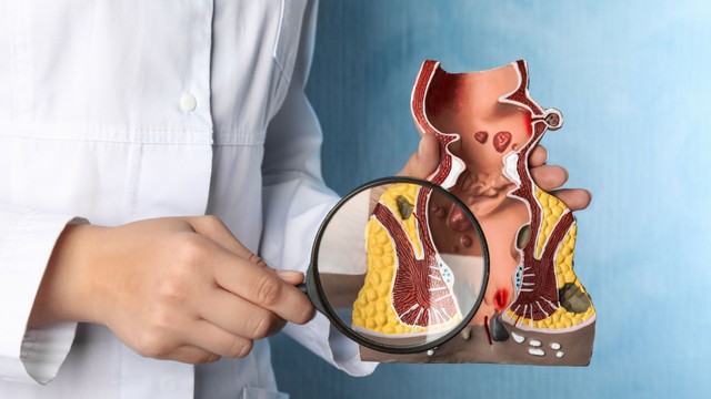 Cấu tạo bình thường của hậu môn như thế nào? Một số bệnh lý liên quan đến hậu môn