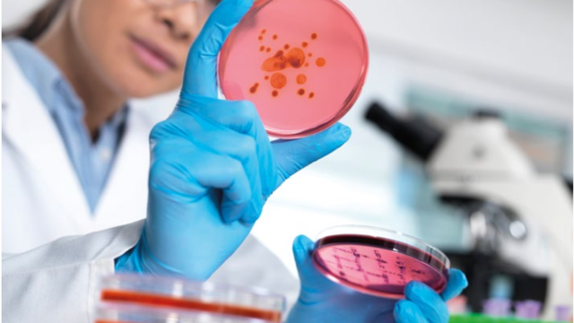 Cấy phân là gì và khi nào cần thực hiện xét nghiệm này?