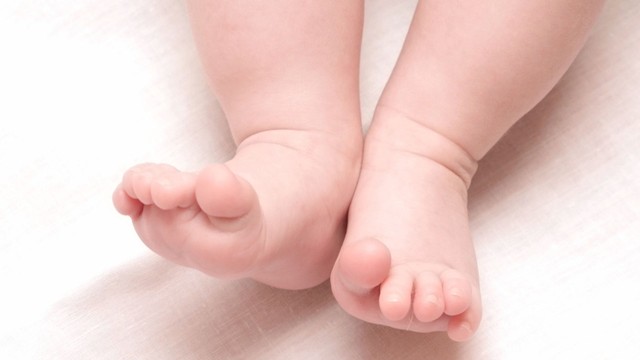 Chân vòng kiềng ở trẻ: Dấu hiệu, nguyên nhân và cách khắc phục hiệu quả