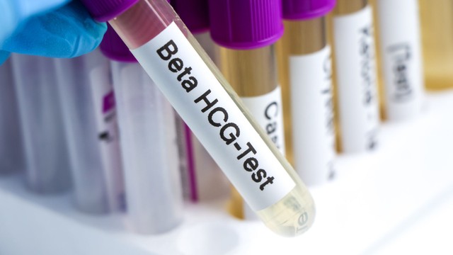 Chỉ số beta hCG sau 7 ngày chuyển phôi ngày 5 bao nhiêu là bình thường? Những lưu ý cần biết