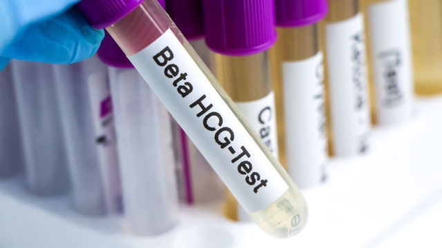 Chỉ số beta HCG thai 2 tuần và những điều mẹ bầu cần biết