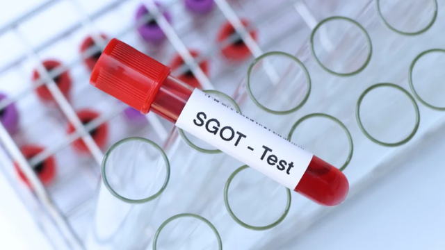 Chỉ số GOT bao nhiêu là bình thường? 