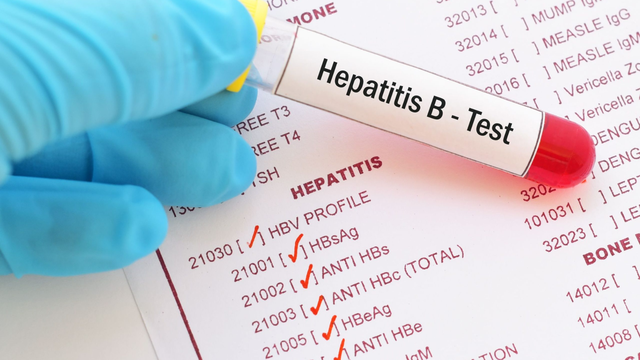 Chỉ số HBsAg bao nhiêu là nguy hiểm? Những điều bạn cần biết