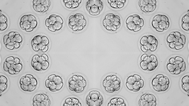 Chuyển phôi: Quy trình, hiệu quả và các yếu tố ảnh hưởng thành công