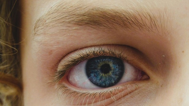 Co đồng tử là gì? Triệu chứng và cách điều trị