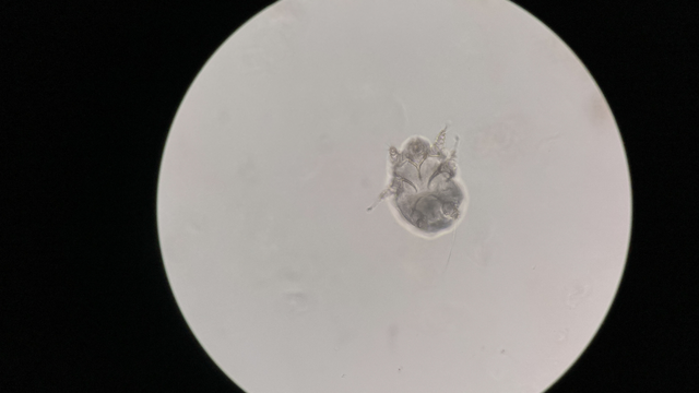 Con ghẻ là con gì? Gây hại như thế nào?