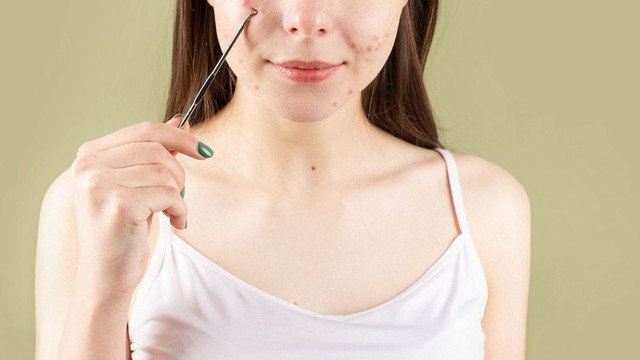 Nổi mụn nội tiết nên uống gì​? Các thực phẩm giúp giảm tình trạng mụn nội tiết