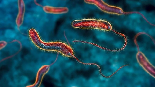 Vi khuẩn tả - Đặc điểm và cách phòng ngừa hiệu quả