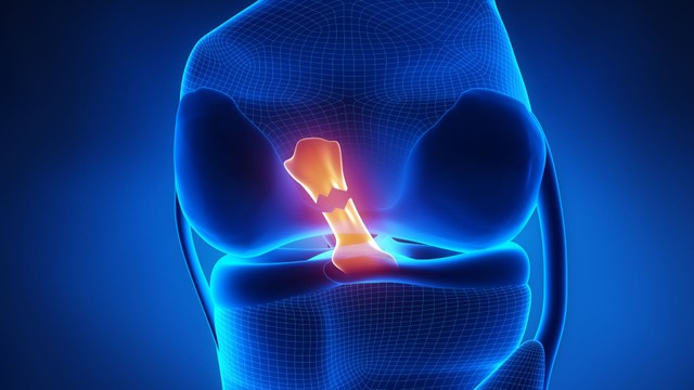Dây chằng chéo trước: Cấu tạo, vai trò và chấn thương thường gặp