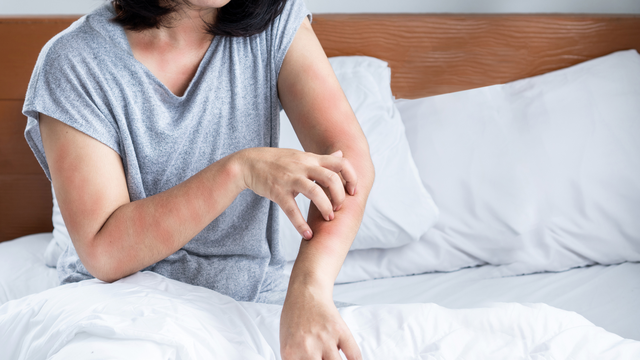 Dị ứng là gì? Nguyên nhân, chẩn đoán, điều trị và phòng ngừa